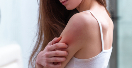Estudo indica que dermatite atópica tem impacto negativo a vários níveis na vida dos doentes