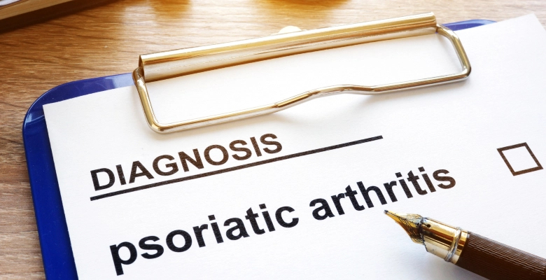 A urgência de definir objetivos no tratamento da artrite psoriática